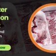 Freezer Burn on Meat_ Causes and Prevention